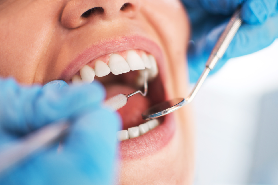 Gum Disease Treatment In Denver Colorado